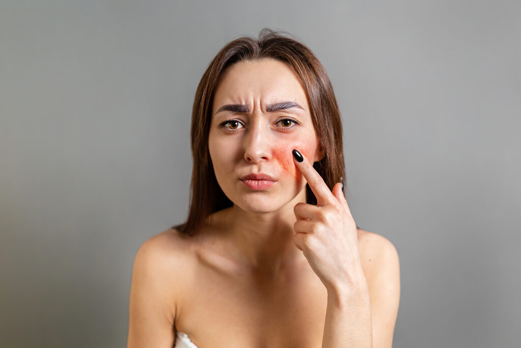 woman points a finger at a red cheek with inflammation