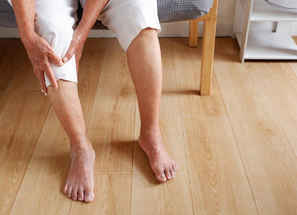 Elderly asian woman holding a leg that is painful from varicose veins