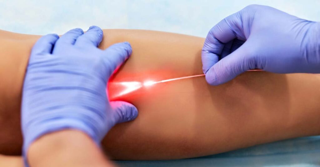 Varicose laser treatment on legs in clinic