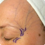 Vein Conditions Check in Melbourne