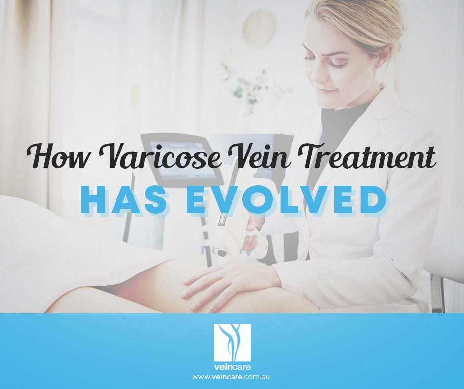 History of Varicose Vein Treatments Has Evolved