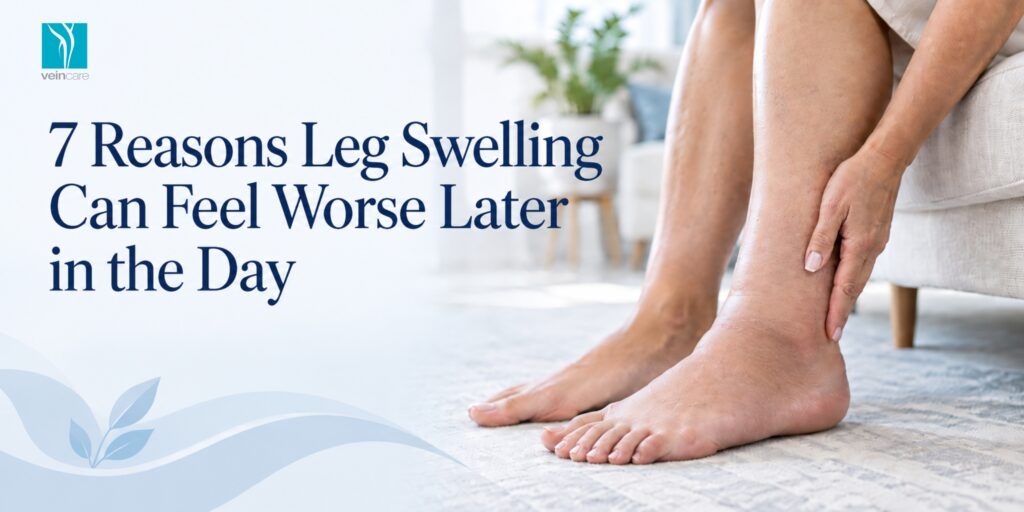 7 Reasons Leg Swelling Can Feel Worse Later in the Day