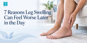 7 Reasons Leg Swelling Can Feel Worse Later in the Day