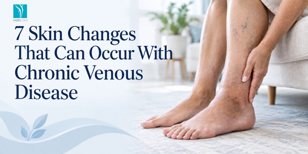 7 Skin Changes That Can Occur With Chronic Venous Disease