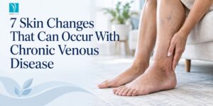 7 Skin Changes That Can Occur With Chronic Venous Disease