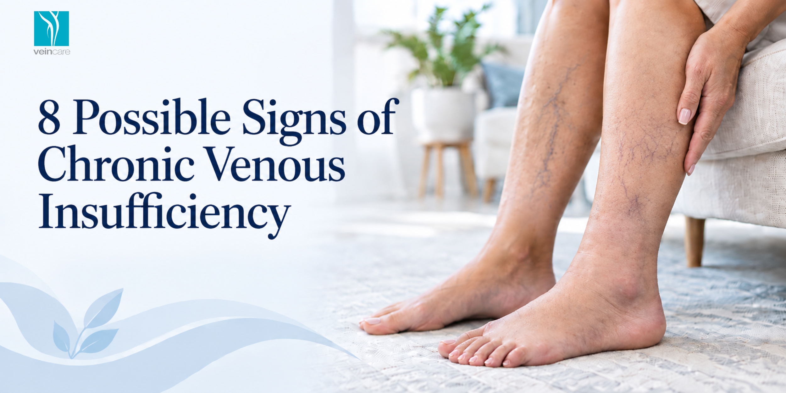 8 Possible Signs of Chronic Venous Insufficiency