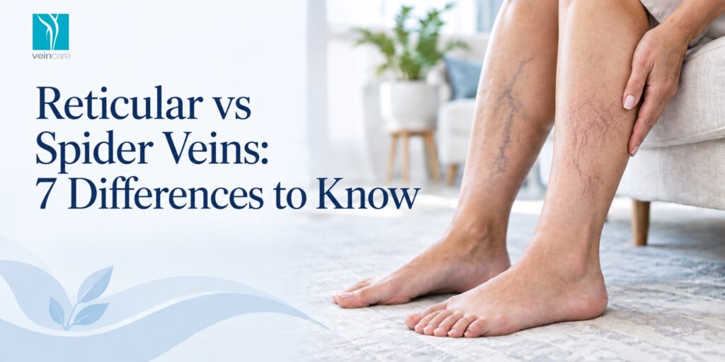 Reticular vs Spider Veins: 7 Differences to Know