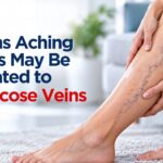 7 Signs Aching Legs May Be Related to Varicose Veins