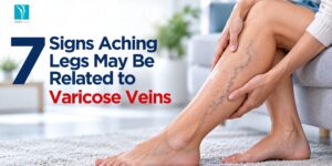 7 Signs Aching Legs May Be Related to Varicose Veins